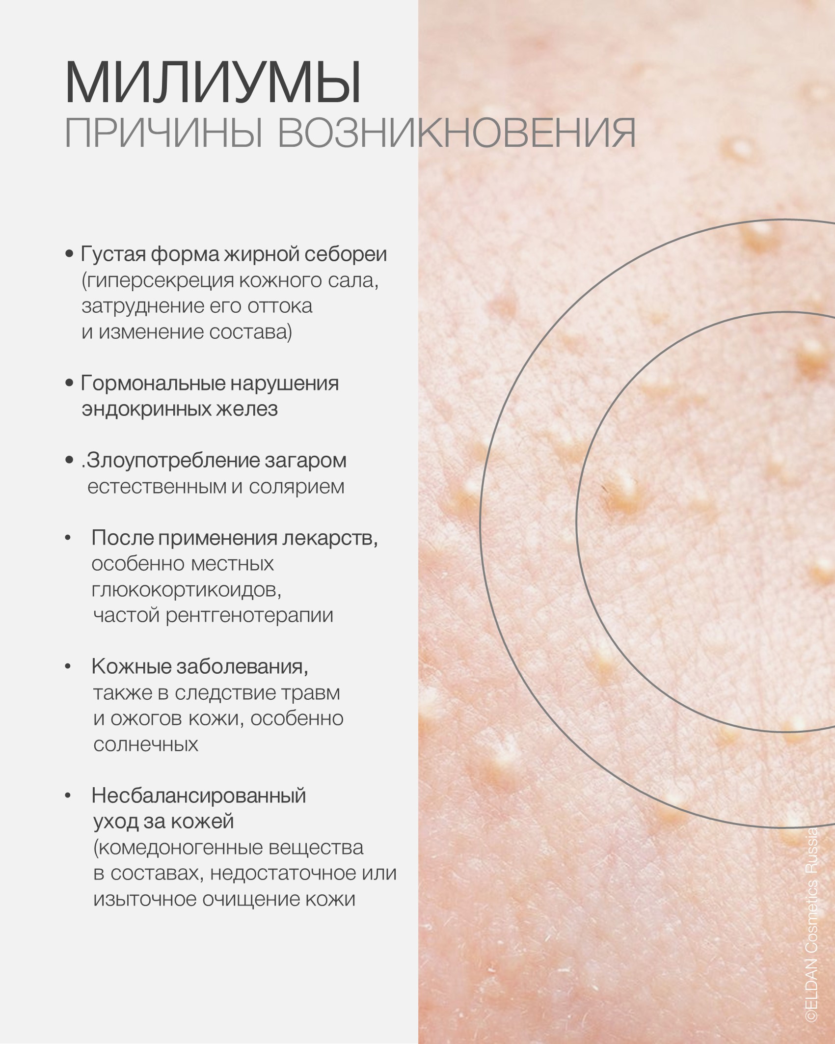 Пост милиумы 3.jpg Пост